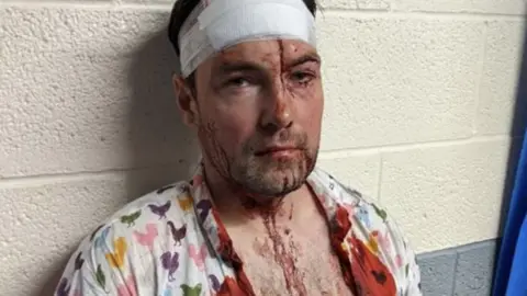 Other One of the victims