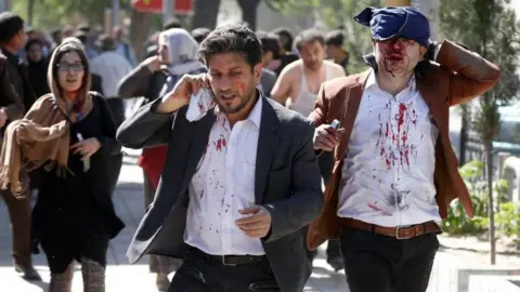 Reuters Injured Afghans run from the site of a blast in Kabul, Afghanistan May 31, 2017.