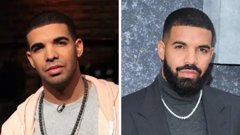 Getty Images Drake now and then