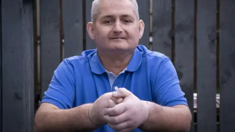 PA Media Steven Gallagher shows his new hands