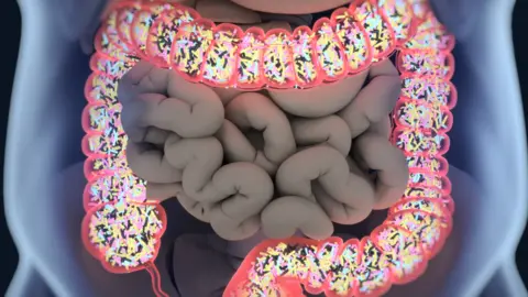 Getty Images Large bowel
