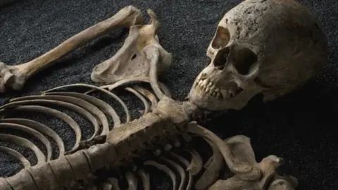 Wellcome Collection A skeleton from the exhibition
