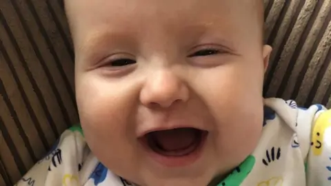 Submitted picture Gabriel is now thriving