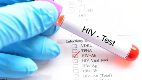 Getty Images An HIV test