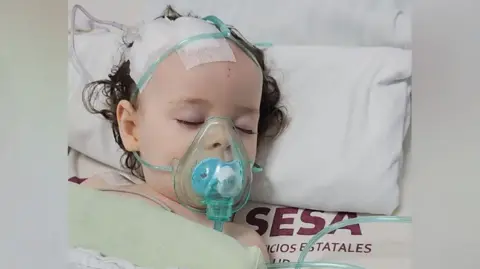 Family handout Sienna-Rose is photographed lying in a hospital bed with a plastic mask covering her nose and mouth. There are bandages on the head of the little girl, who has dark brown, curly hair.