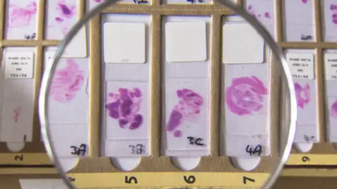 university of leeds Tissue cells stored on glass slides
