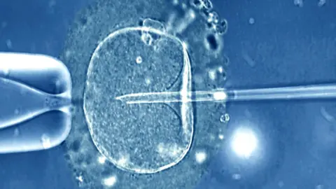 Science Photo Library ivf