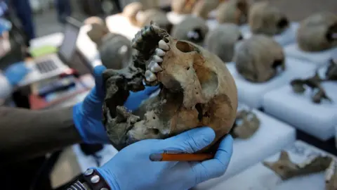 Reuters Someone holds a skull in the labratory