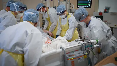 Getty Images Intensive care at Monklands Hospital