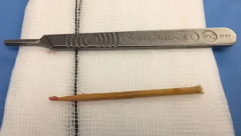 Dick White Referrals Stick after being removed from cat