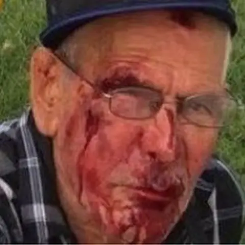 Erik Mendoza/GoFundMe Photo of Mr Rodriguez's bloody face