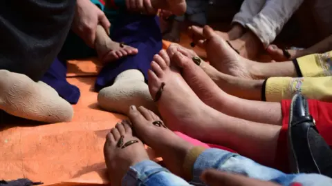 Getty Images Kashmiri people take Leech treatment on the banks of Dal Lake Srinagar, Indian Administered Kashmir