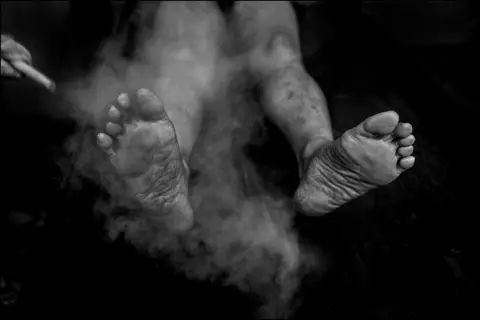 Judah Passow Steam therapy