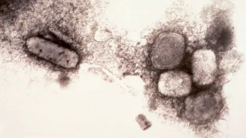 Smith Collection/Gado/Getty Images Electron micrograph of the smallpox virus (variola), 1970