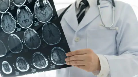 Getty Images/utah778 Doctor examining brain scan results