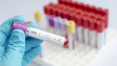 Getty Images HIV blood test