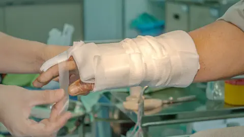 MangTeng/Getty Images Burns victim (stock photo)