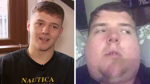 BBC Student Olly Finch had mumps
