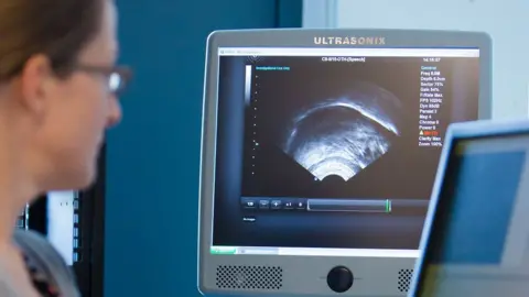 Researcher looking at ultrasound recording of a tongue