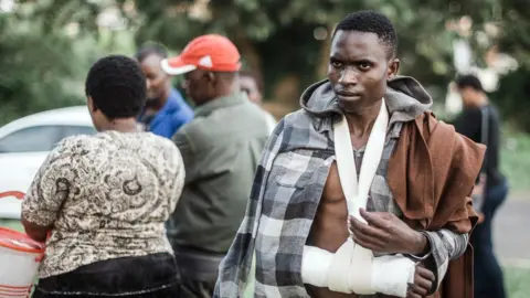 Getty Images A man from Malawi injured after an attack on foreign workers