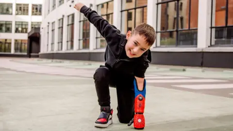 7-Year-Old Boy Holds Fishing Rod With Bionic Limb In Inspirational Moment -  Zenger News