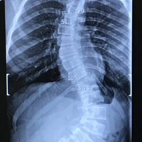 Spire Hospital Erin's X-ray