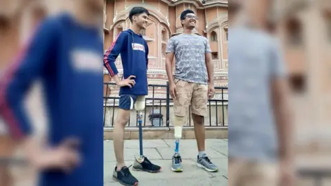 De Montfort University Amputees at Bhagwan Mahaveer Viklang Sahavata Samiti