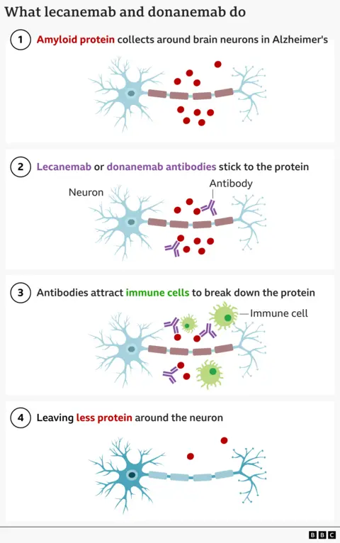 Graphic showing how the lecanemab or donanemab antibodies stick to the protein which builds up around the neuron's in the brain of someone with Alzheimer's. This then helps the bodies immune cells target and remove the protein from the brain.