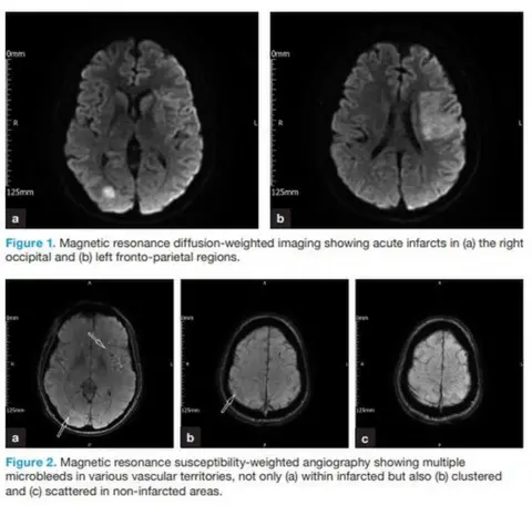 British Journal of Hospital Medecine brain images