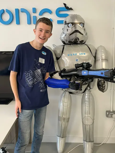 Family Joshua with his new arm