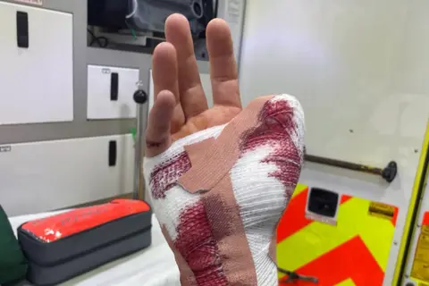 Mr Jenkinson's bandaged hand