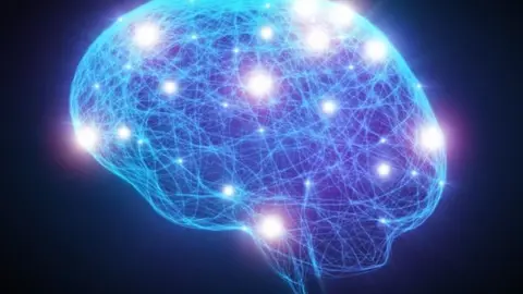 Getty Images Neurology graphic