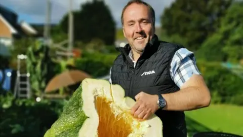 Kevin Fortey Kevin and his marrow