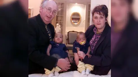 PA Media Judith and Alan Kilshaw with the twins