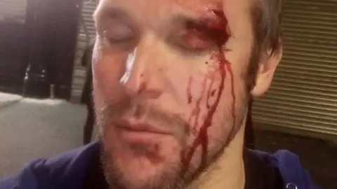 John-Paul Kesseler John-Paul Kesseler after the attack