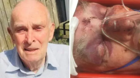 Family photos John Miller before and after accident