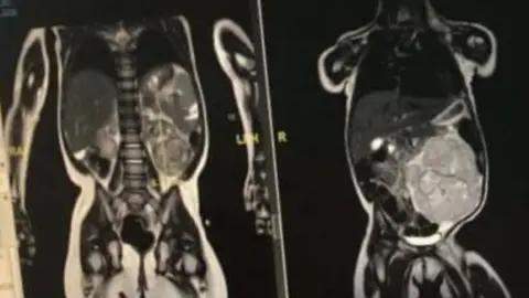 Kelly Marshall  Before and after scans