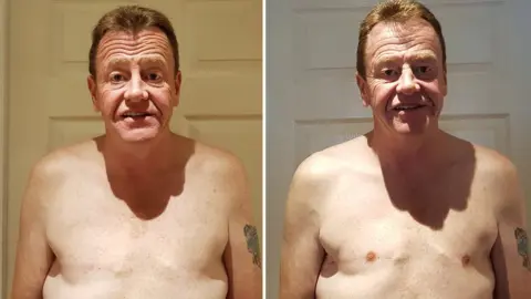 Peter Bagnall Peter, before and after having nipple tattoos