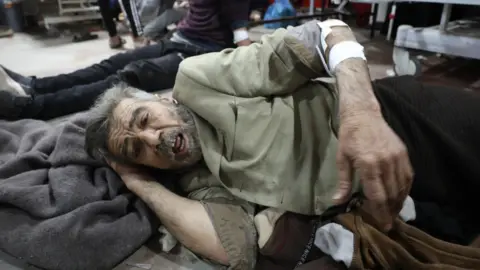 Getty Images Zranění Palestinci byli převezeni do nemocnice Al-Shifa ve městě Gaza k ošetření