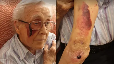 Rebecca Robb Mr Calloway days after his fall