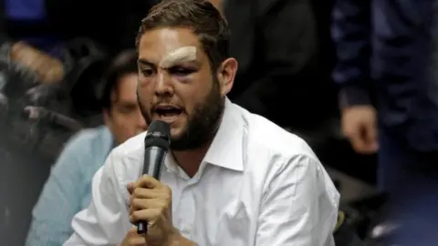 Reuters Juan Requesens, deputy of the Venezuelan coalition of opposition parties (MUD), speaks during a session of the National Assembly in Caracas, Venezuela April 5, 2017