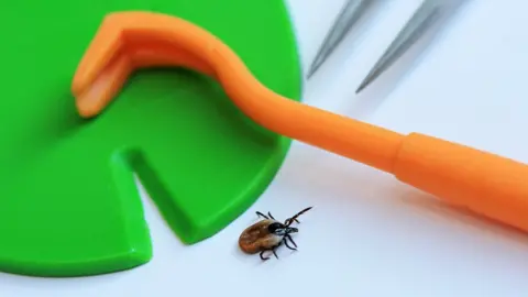 Getty Images Removing a tick