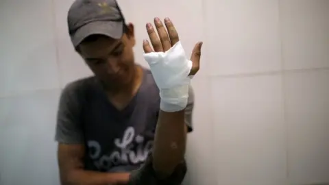 Reuters A protester holds up an injured and bandaged hand