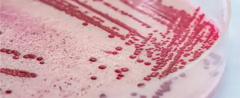 Getty Images Listeria bacteria in a petri dish