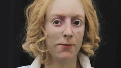 Bonnie Prince Charlie facial reconstruction