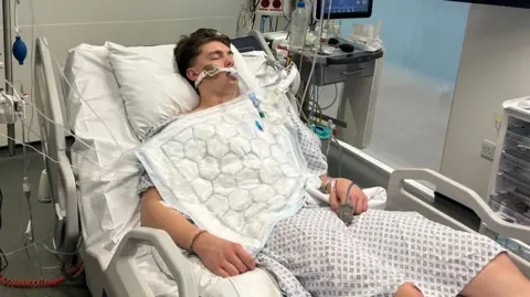 Supplied A man in a hospital gown in bed with tubes coming out of his mouth.