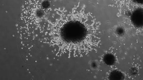 Friedrich Miescher Institute/University of Cambrid Placental organoid