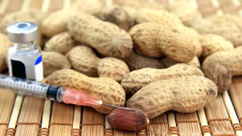 Getty Images Oli's allergy means simply taking medication after coming in to contact with nuts might not be enough to save his life.