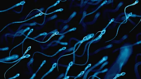 Getty Images A graphic of sperm
