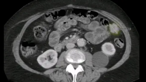 Other Anne Shaw's scan in 2019